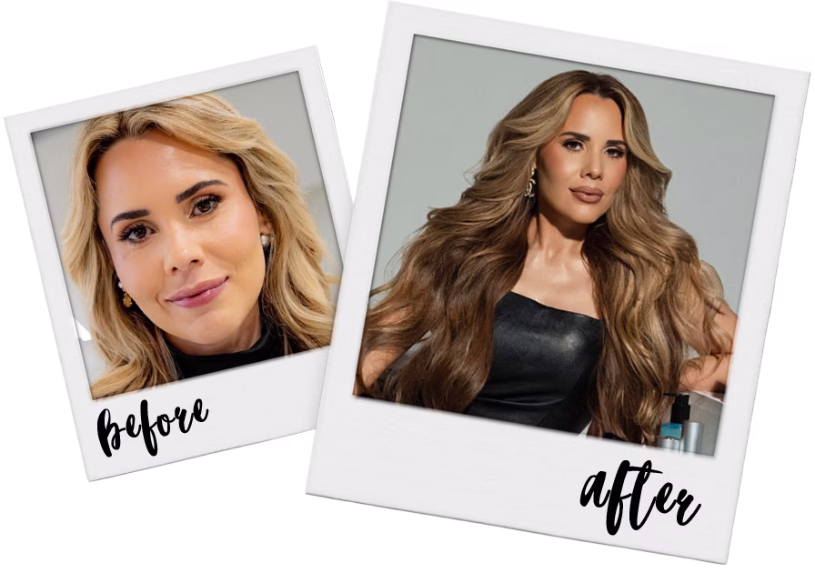 before-after-25
